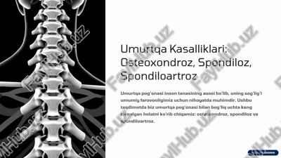 umurtqa kasalliklari: osteoxondroz, spondiloz, spondiloartroz — PPTX