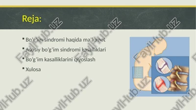 bo’g’im sindromi — PPTX