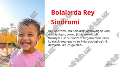 bolalarda rey sindromi — PPTX