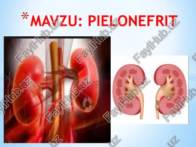 pielonefrit — PPTX