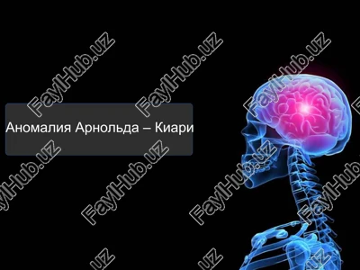 anomaliya arnolda – kiari — PPT