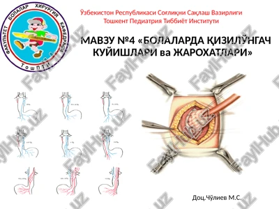 "bolalarda qizilo'ngach kuyishlari va jaroxatlari" — PPTX