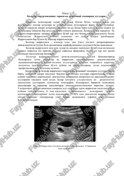 bolalar jarrohligi — DOCX