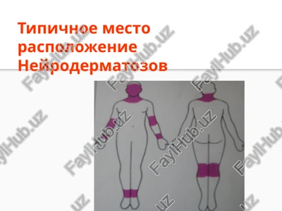 neyrodermatozov — PPTX
