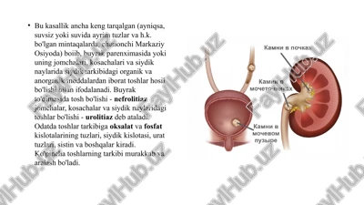 buyrak tosh kasalliklari patologik fiziologiyasi pptx — PPTX