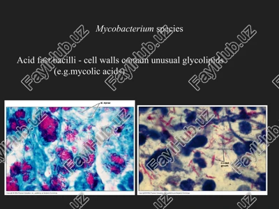 mycobacterium species — PPTX