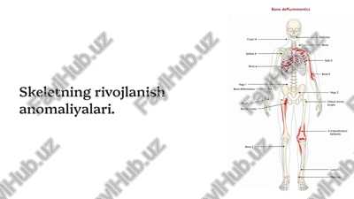 skeletning rivojlanish anomaliyalari — PPTX