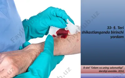 teri shikastlanganda birinchi yordam. 8 - sinf — PPTX