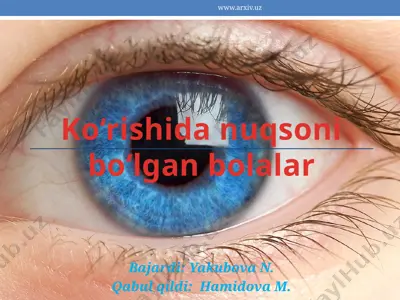 ko‘rishida nuqsoni bo‘lgan bolalar — PPTX