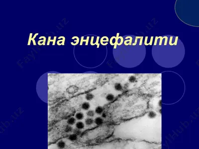кана энцефалити — PPTX