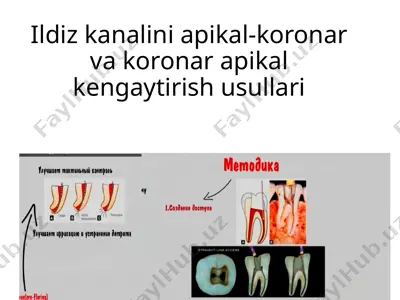 ildiz kanalini apikal-koronar va koronar apikal kengaytirish usullari — PPTX