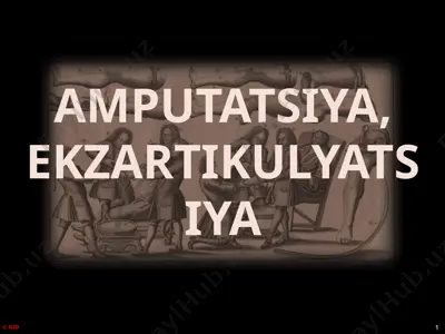 amputatsiya, ekzartikulyatsiya — PPTX