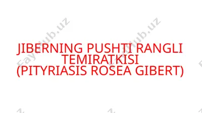 jiberning pushti rangli temiratkisi (pityriasis rosea gibert) — PPTX