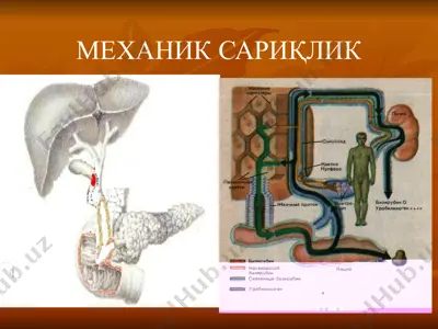 механик сариқлик — PPTX