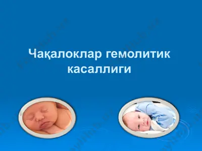 чақалоклар гемолитик касаллиги — PPTX