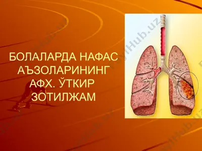 болаларда нафас аъзоларининг афх. ўткир зотилжам — PPTX