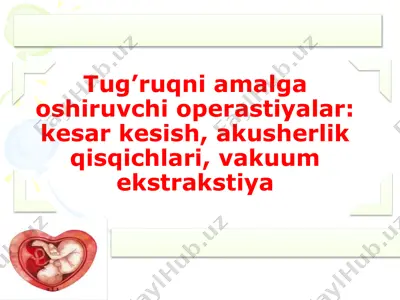tug’ruqni amalga oshiruvchi operastiyalar - kesar kesish, akusherlik qisqichlari, vakuum ekstrakstiya — PPTX