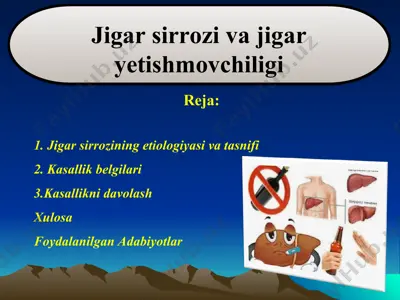 jigar sirrozi va jigar yetishmovchiligi — PPT