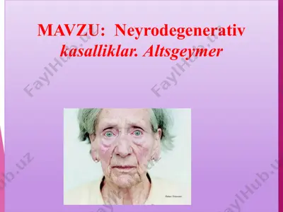 neyrodegenerativ kasalliklar. altsgeymer — PPTX
