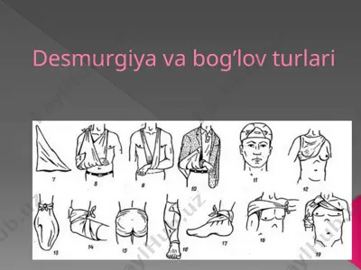 desmurgiya va bog’lov turlari — PPTX