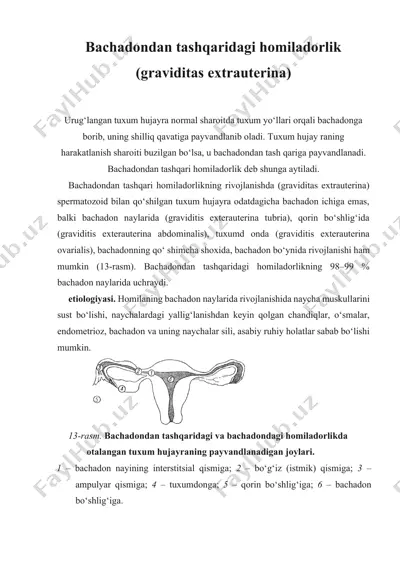 bachadondan tashqaridagi homiladorlik (graviditas extrauterina) — ZIP