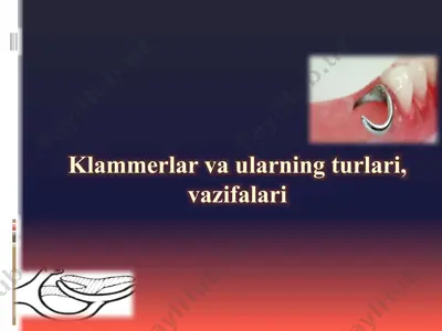 klammerlar va ularning turlari, vazifalari — PPTX