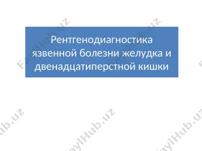 рентгенодиагностика язвенной болезни желудка и двенадцатиперстной кишки — PPT
