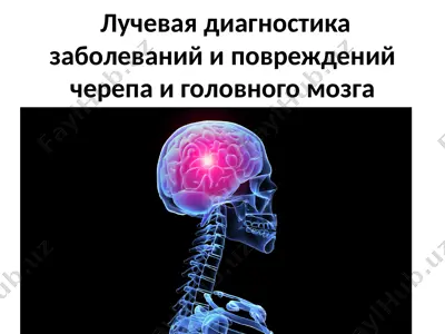 лучевая диагностика заболеваний и повреждений черепа и головного мозга — PPTX