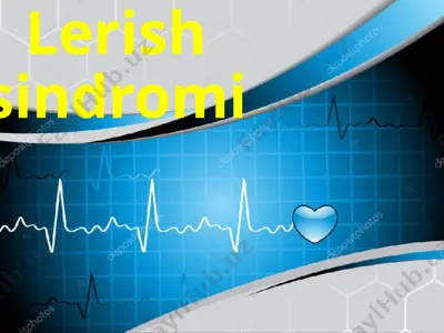 lerish sindromi — PPT