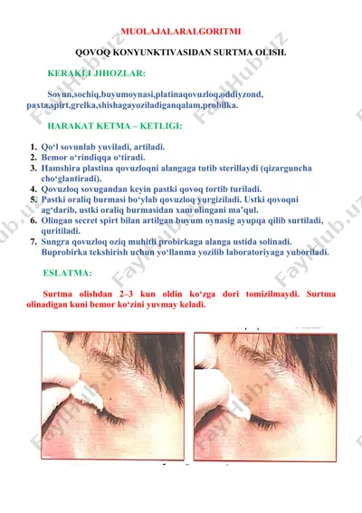 ko‘z muolajalar algoritmi — DOCX