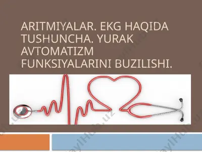 aritmiyalar. ekg haqida tushuncha. yurak avtomatizm funksiyalarini buzilishi. — PPTX