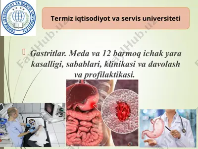 gastritlar. meda va 12 barmoq ichak yara kasalligi, sabablari, klinikasi va davolash va profilaktikasi — PPT