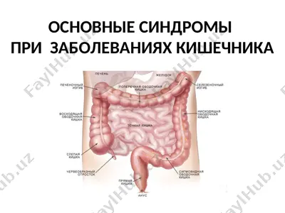 основные синдромы при заболеваниях кишечника — PPT