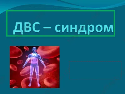 mikrotsirkulyator uzun trombozi va konning kublab tomirlar ichida ivib kolish sindromi — PPT