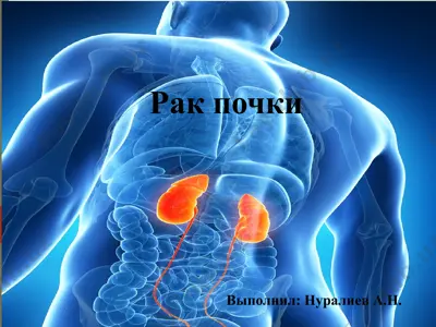 rak pochki — PPT
