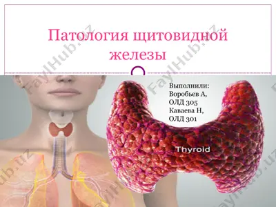 патология щитовидной железы — PPT