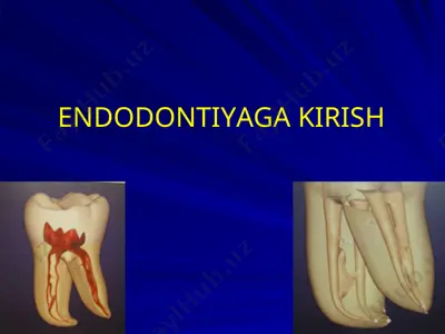 endodontiya — PPT