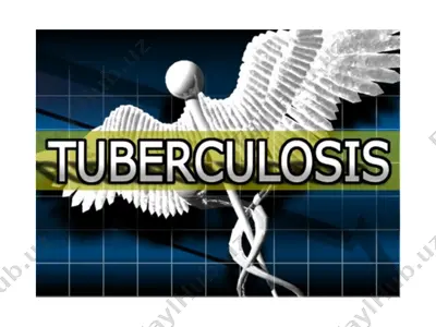 tuberkulёz kasalligi — PPT
