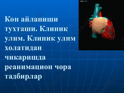 reanimatsiya usullari — PPT
