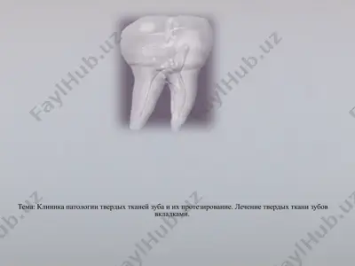 клиника патологии твердых тканей зуба и их протезирование. лечение твердых ткани зубов вкладками. — PPTX