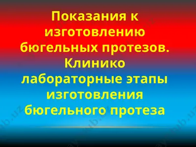 изготовление бюгельных протезов — PPTX