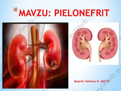 pielonefrit — PPTX