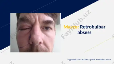 retrobulbar absess — PPTX