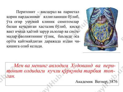 peritonit va uning shifoxonasi — PPT