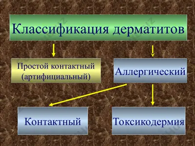 классификация дерматитов — PPT