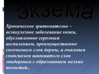 экзема — PPT