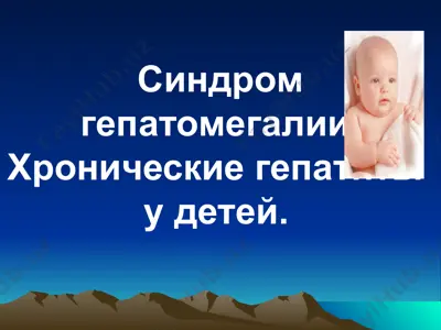 синдром гепатомегалии. хронические гепатиты у детей. — PPTX