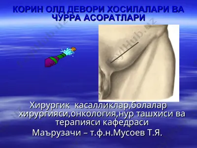 korin o'l davori hosilalari va churra asoratlari — PPT