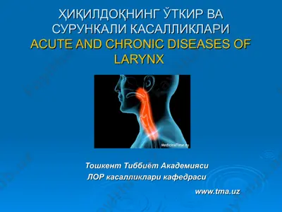 ҳиқилдоқнинг ўткир ва сурункали касалликлари acute and chronic diseases of larynx — PPT