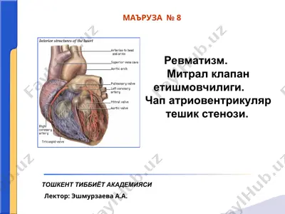 revmatizm — PPT